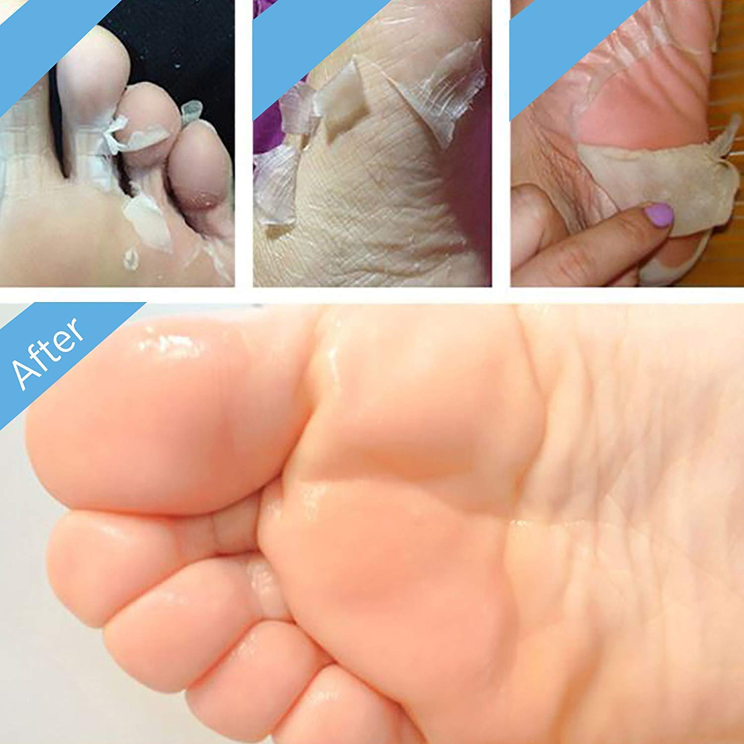 Bealuz bare feet after peel with soft, revived skin