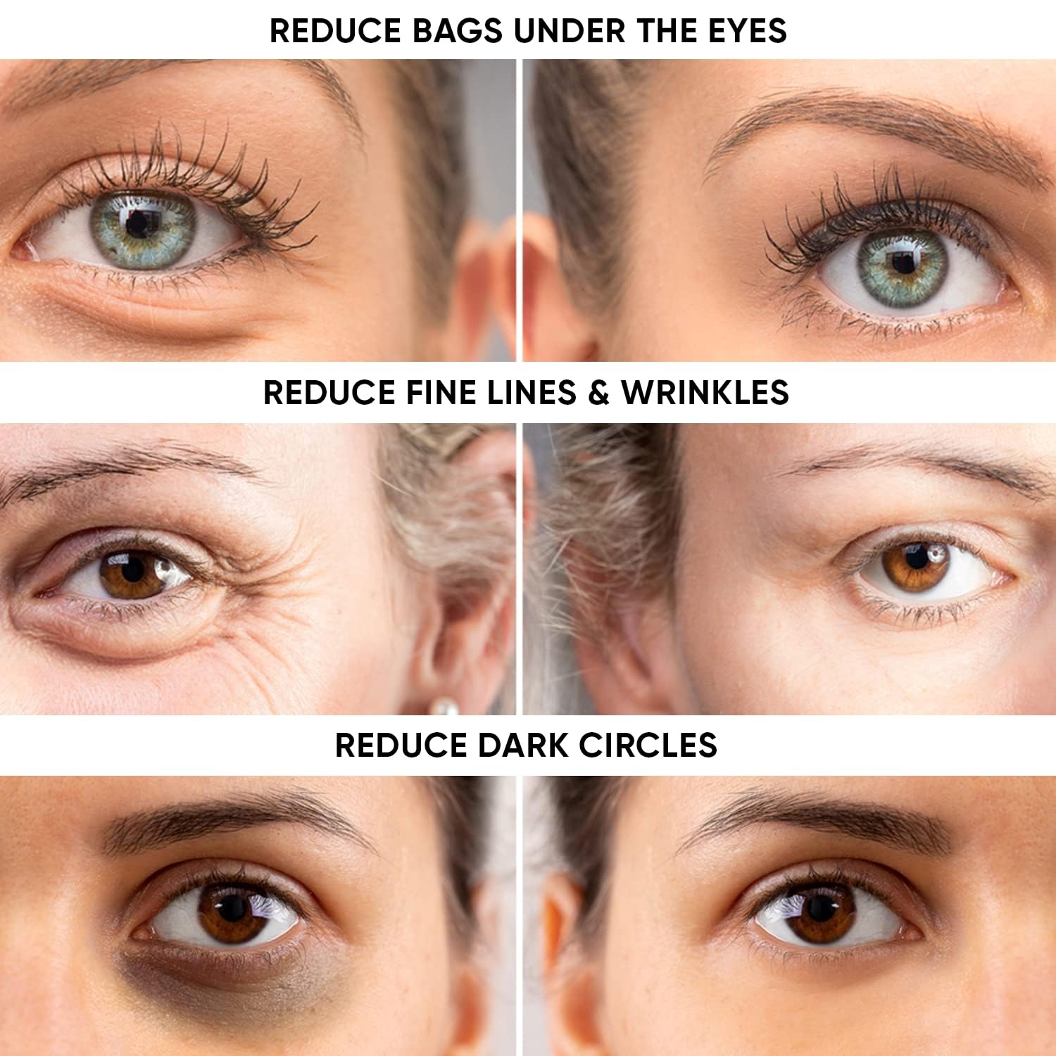 Beatool Instant Ageless Eye Cream under-eye area shows reduced puffiness for refreshed look.