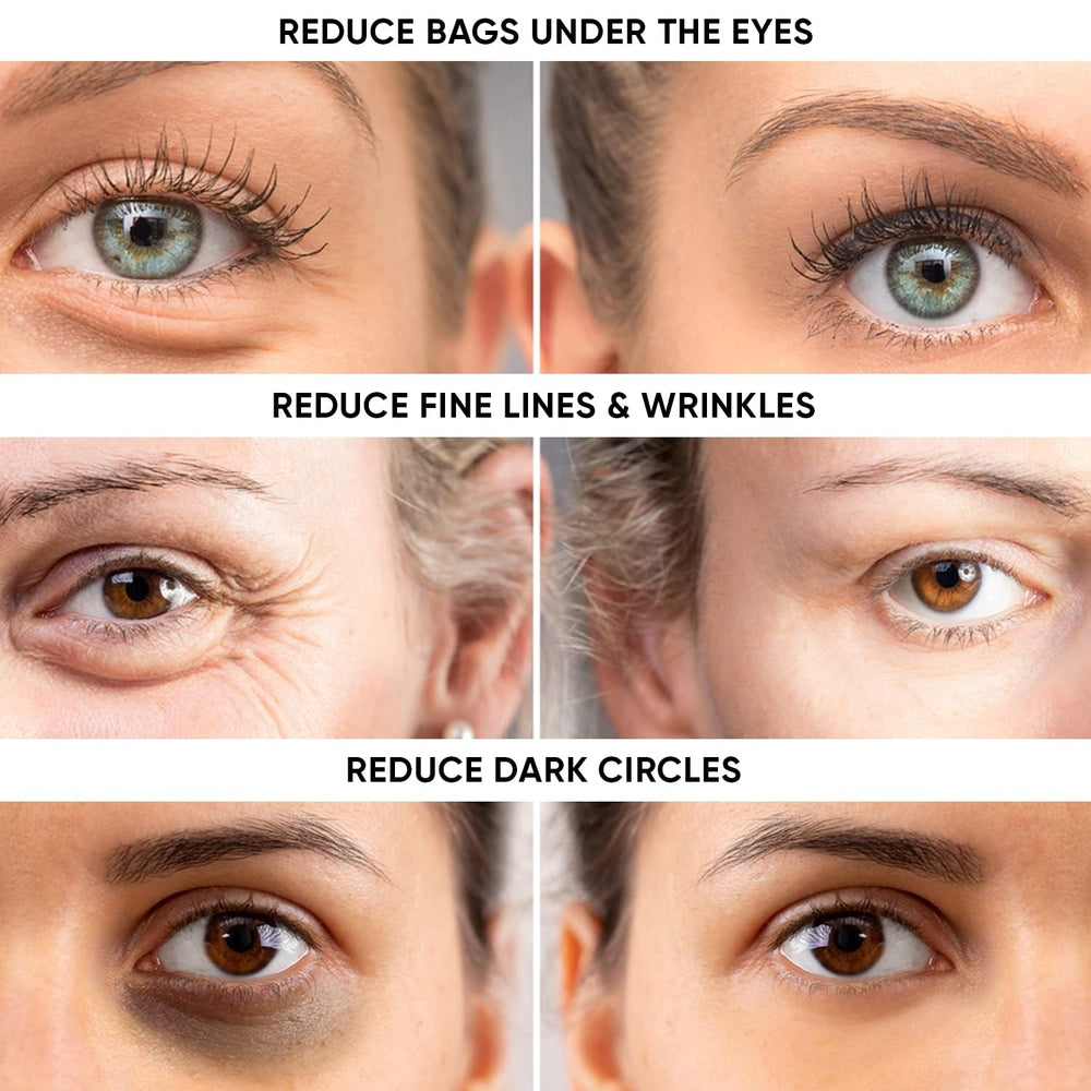 Beatool Instant Ageless Eye Cream under-eye area shows reduced puffiness for refreshed look.