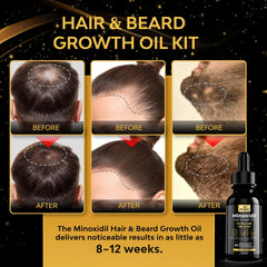 Beaueli minoxidil beard growth kit pump dispense for easy nightly application.