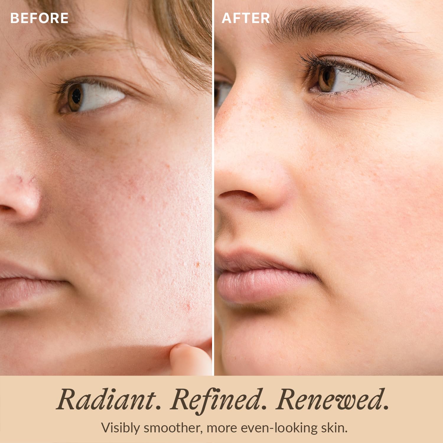 Beauty by Earth bakuchiol serum dropper closeup emphasizes gentle plant-based option