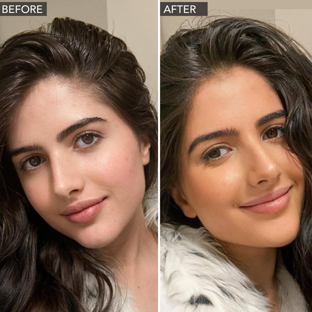 Beauty by Earth before-after close-up demonstrates gradual sunless tan results.