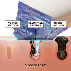BeautyBio GLOfacial concentrates highlight Clarifying formula for oil control and clarity.
