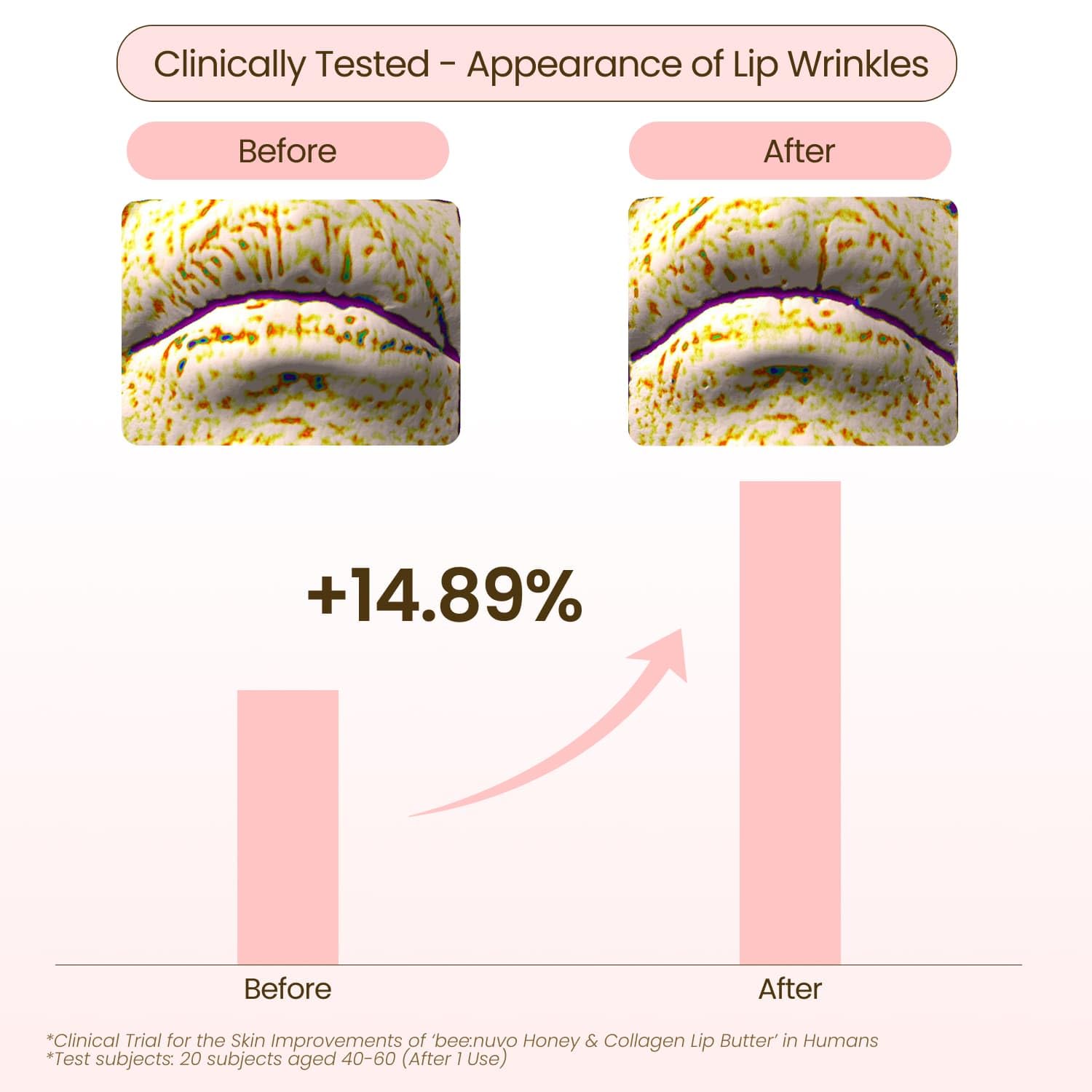 Beenuvo Honey & Collagen Lip Butter on lips shows nourished, supple texture.