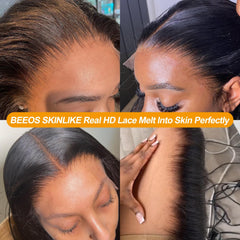 Beeos 0.10mm skinlike lace detail blends invisibly across skin tones.