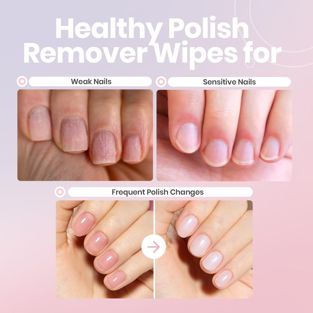 Beetles Non-Acetone Nail Polish Remover is non-drying and skin-friendly care.