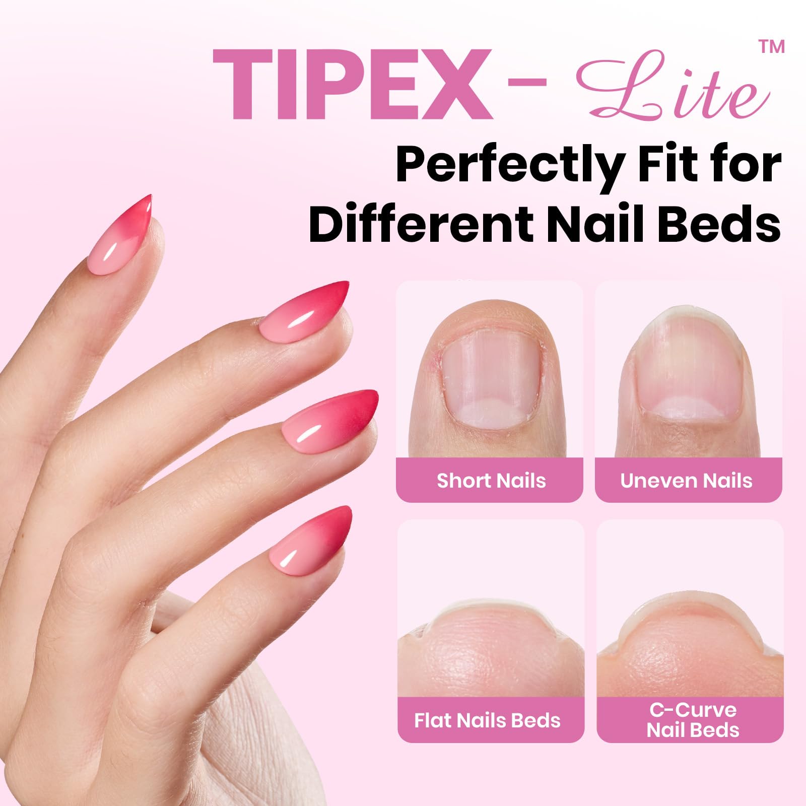 Beetles Tipex Lite tips show pre-etched edges for faster prep and shaping.