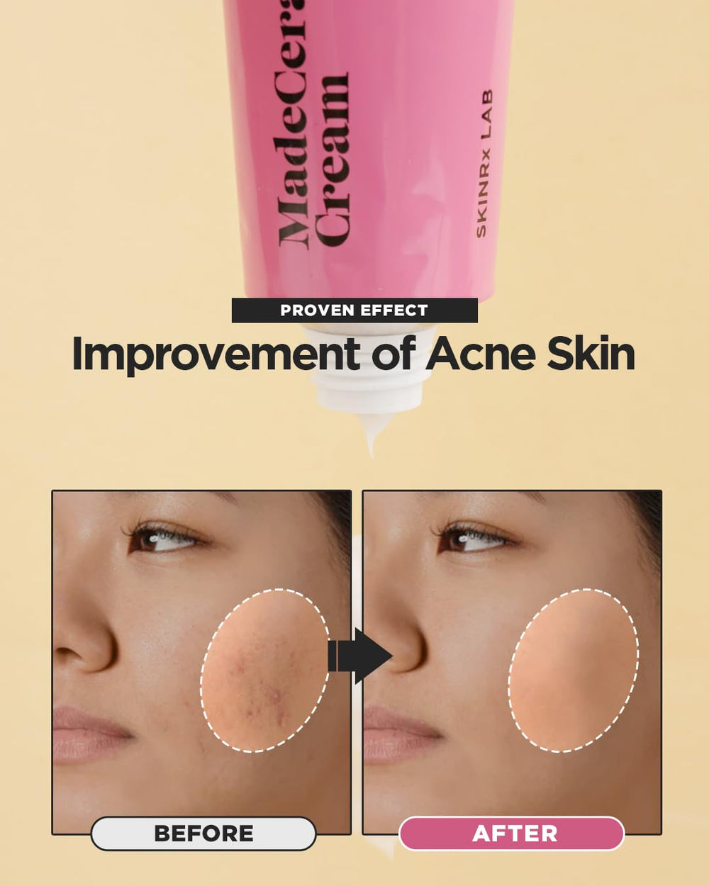 BEISIKS SKINRxLAB Made Cera Cream hand-application for easy moisturization