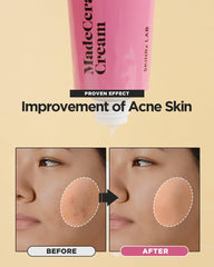 BEISIKS SKINRxLAB Made Cera Cream hand-application for easy moisturization