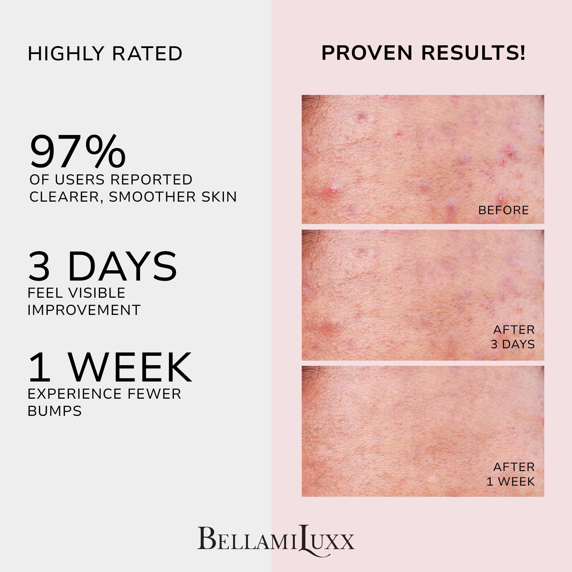BellamiLuxx 2% salicylic acid formula highlights exfoliation and clear pores