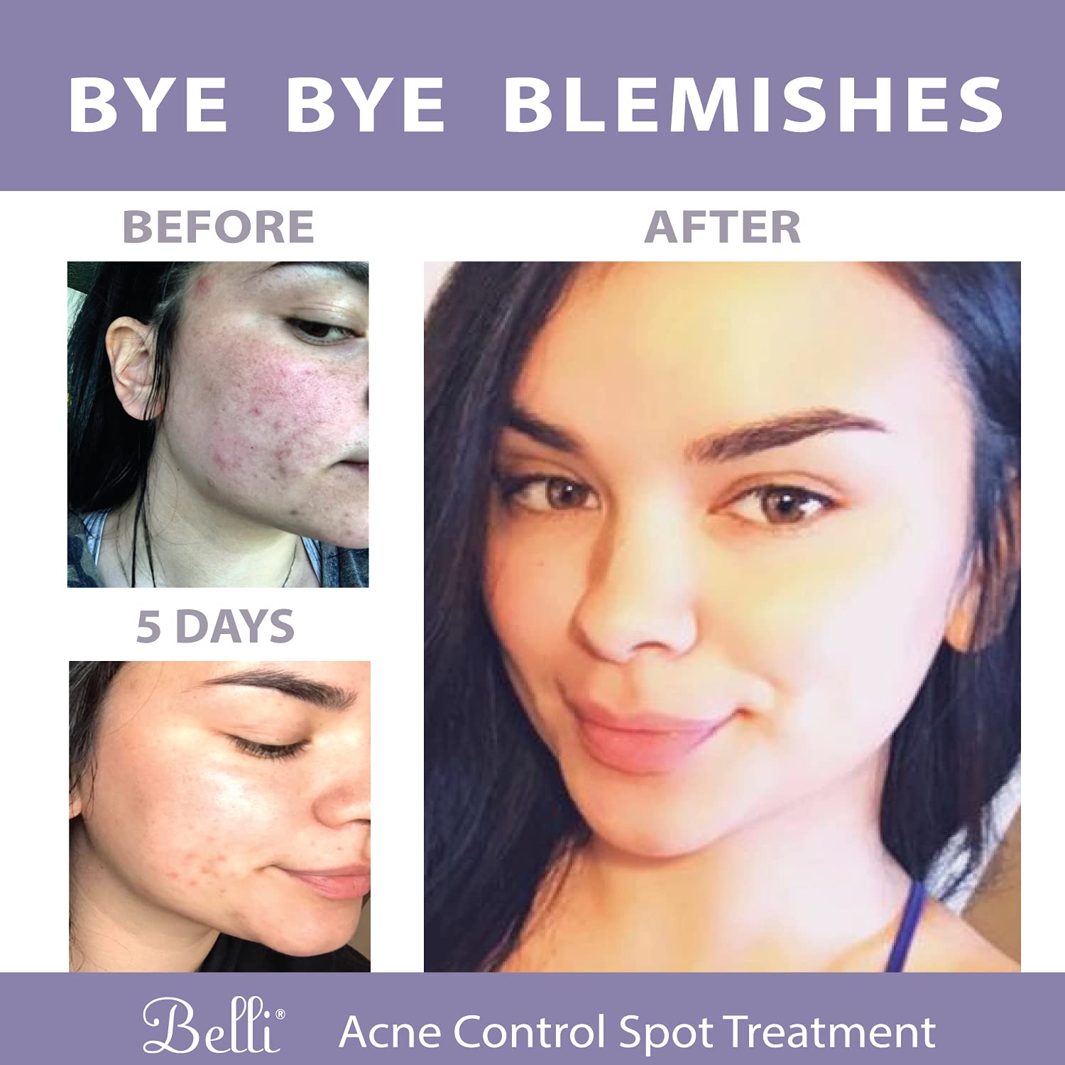Belli label on bottle emphasizing vegan and cruelty-free skincare