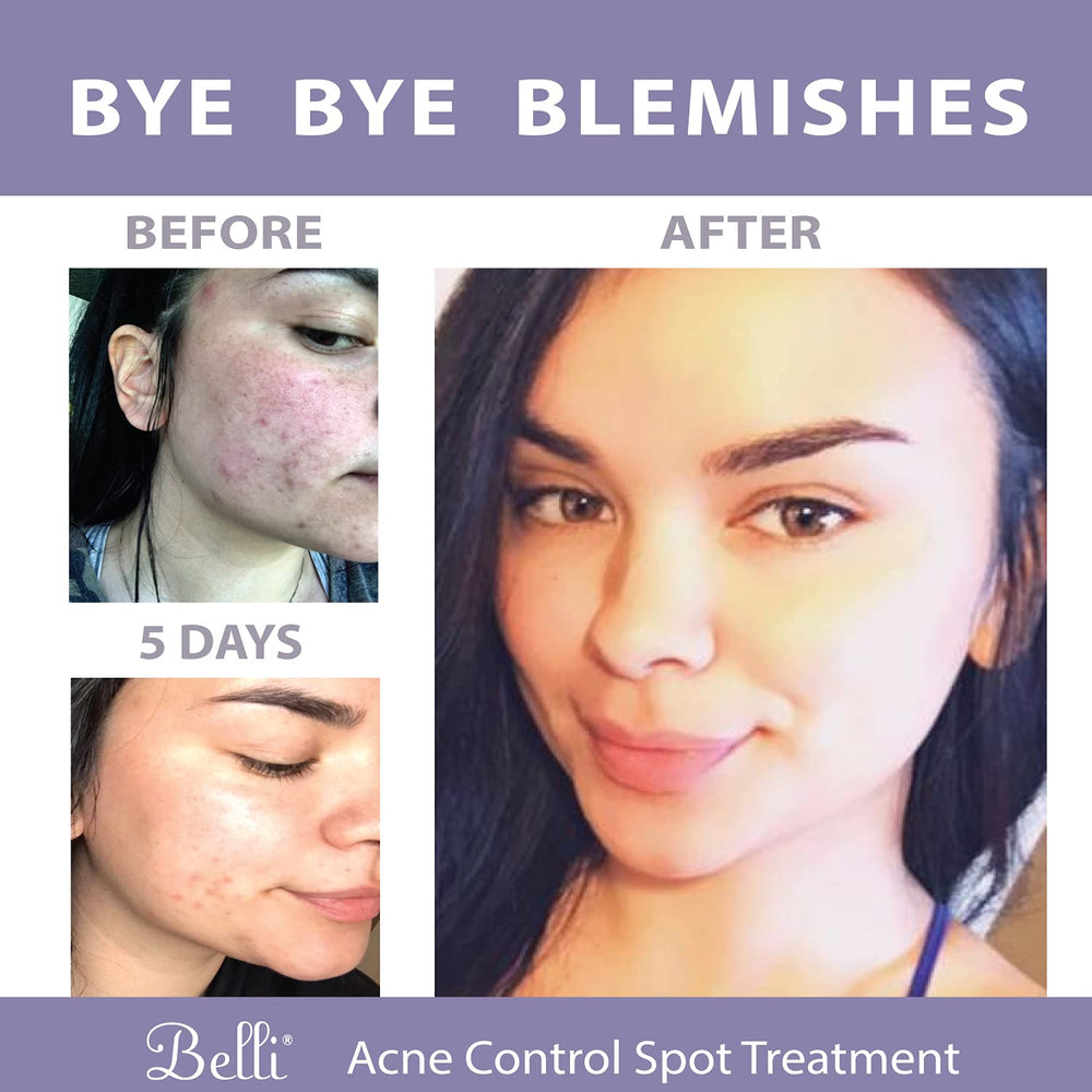 Belli label on bottle emphasizing vegan and cruelty-free skincare