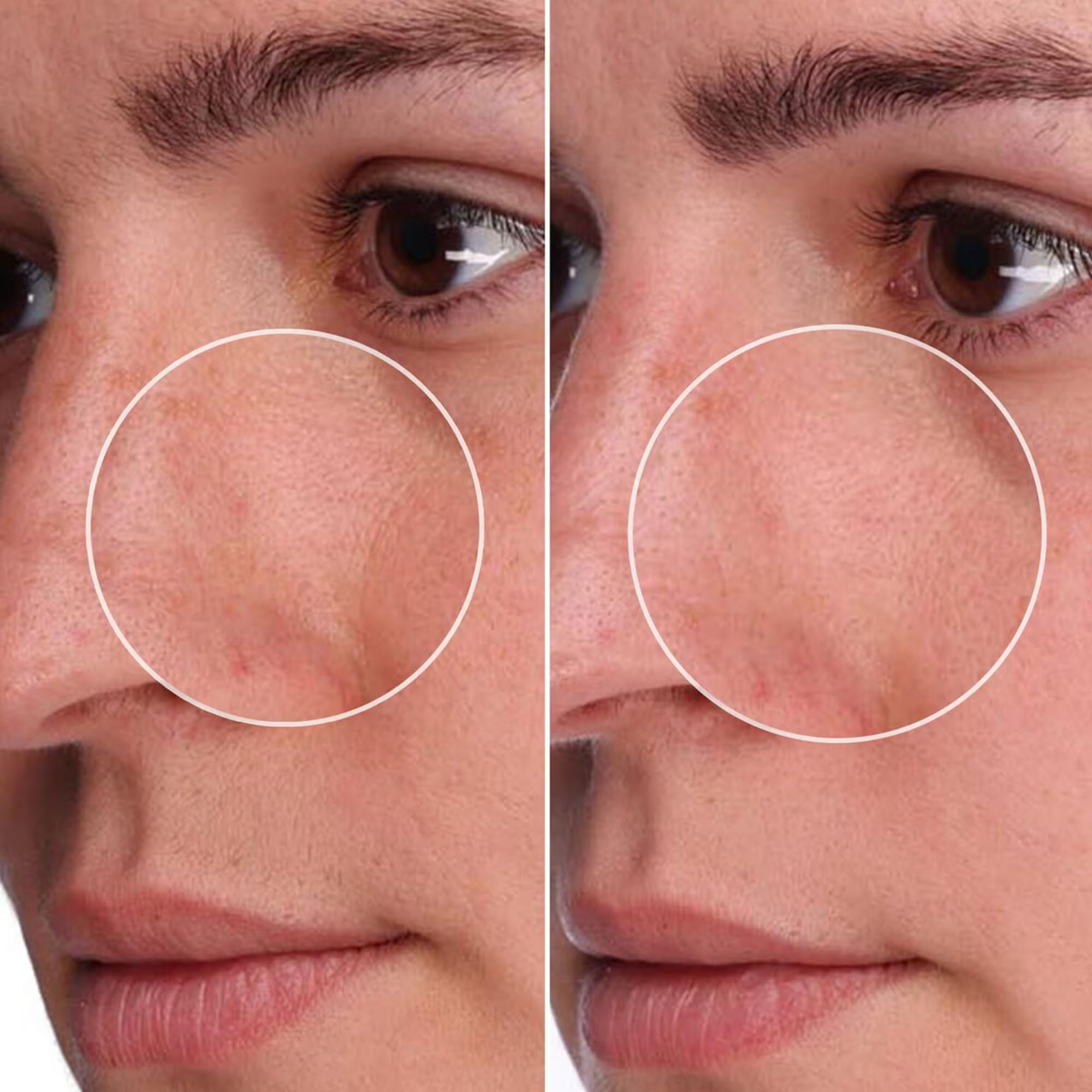 Benefit application on face in use showing even spread and how it settles for visible refinement
