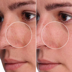 Benefit application on face in use showing even spread and how it settles for visible refinement