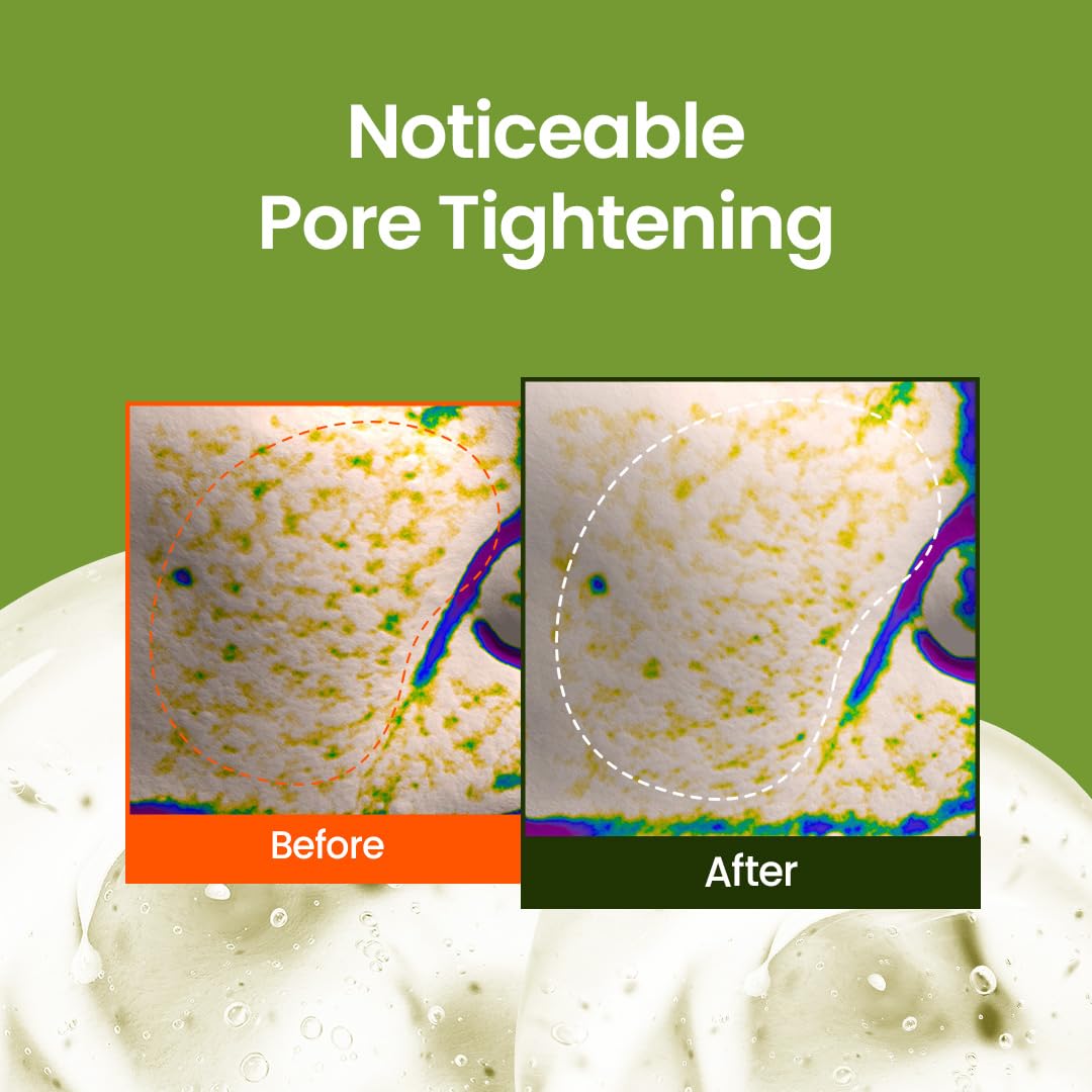 beplain mung bean pore-tight-up serum skin look highlights smoother pores and hydrated glow