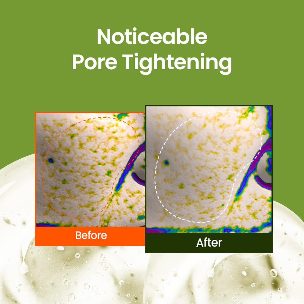 beplain mung bean pore-tight-up serum skin look highlights smoother pores and hydrated glow