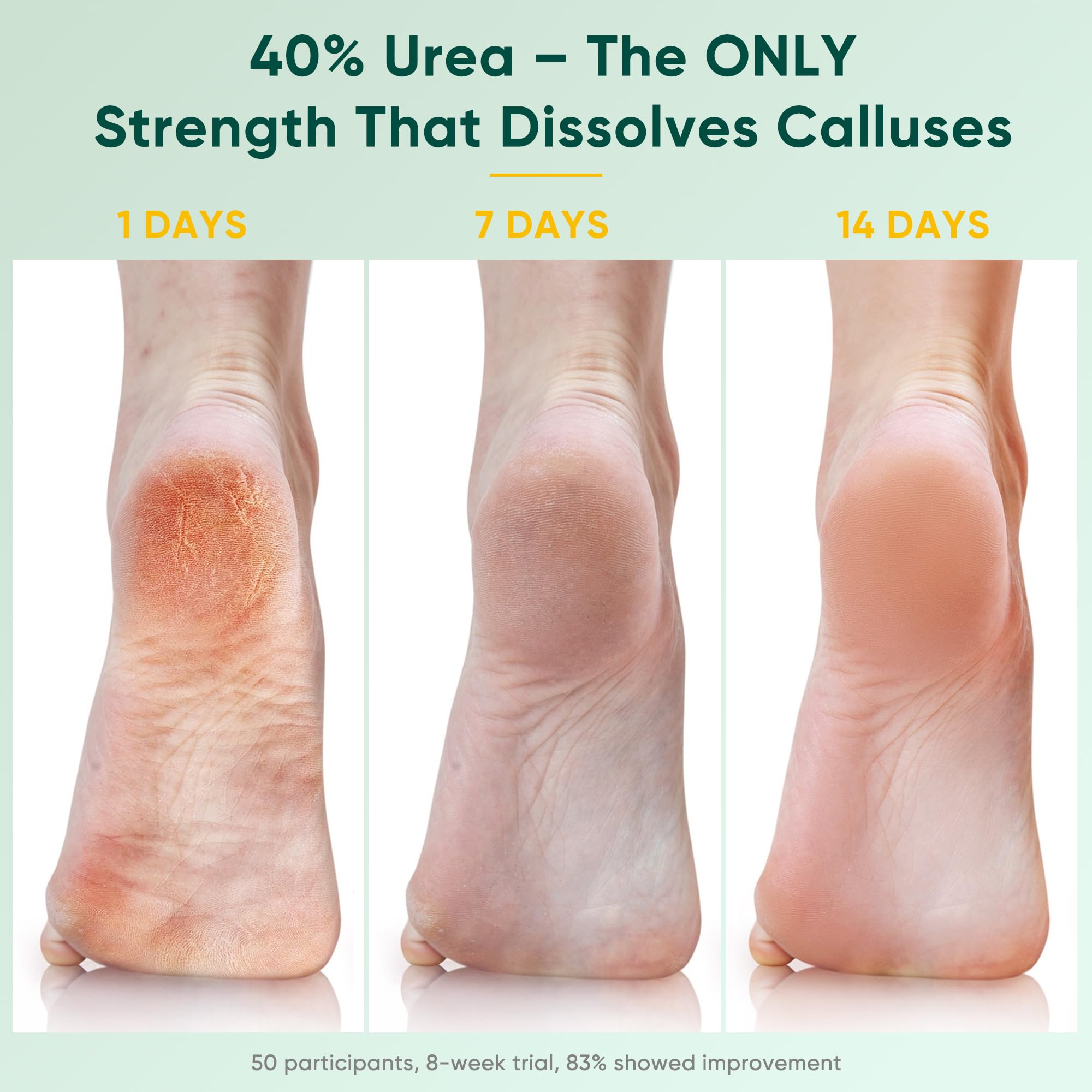 Berlaney Urea Cream dermatologist-tested formula for sensitive skin.