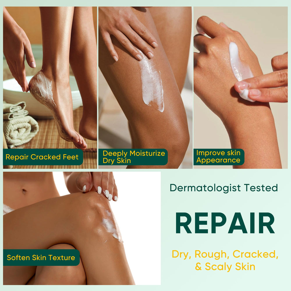 Berlaney Urea Cream on heel calluses for smoothing.