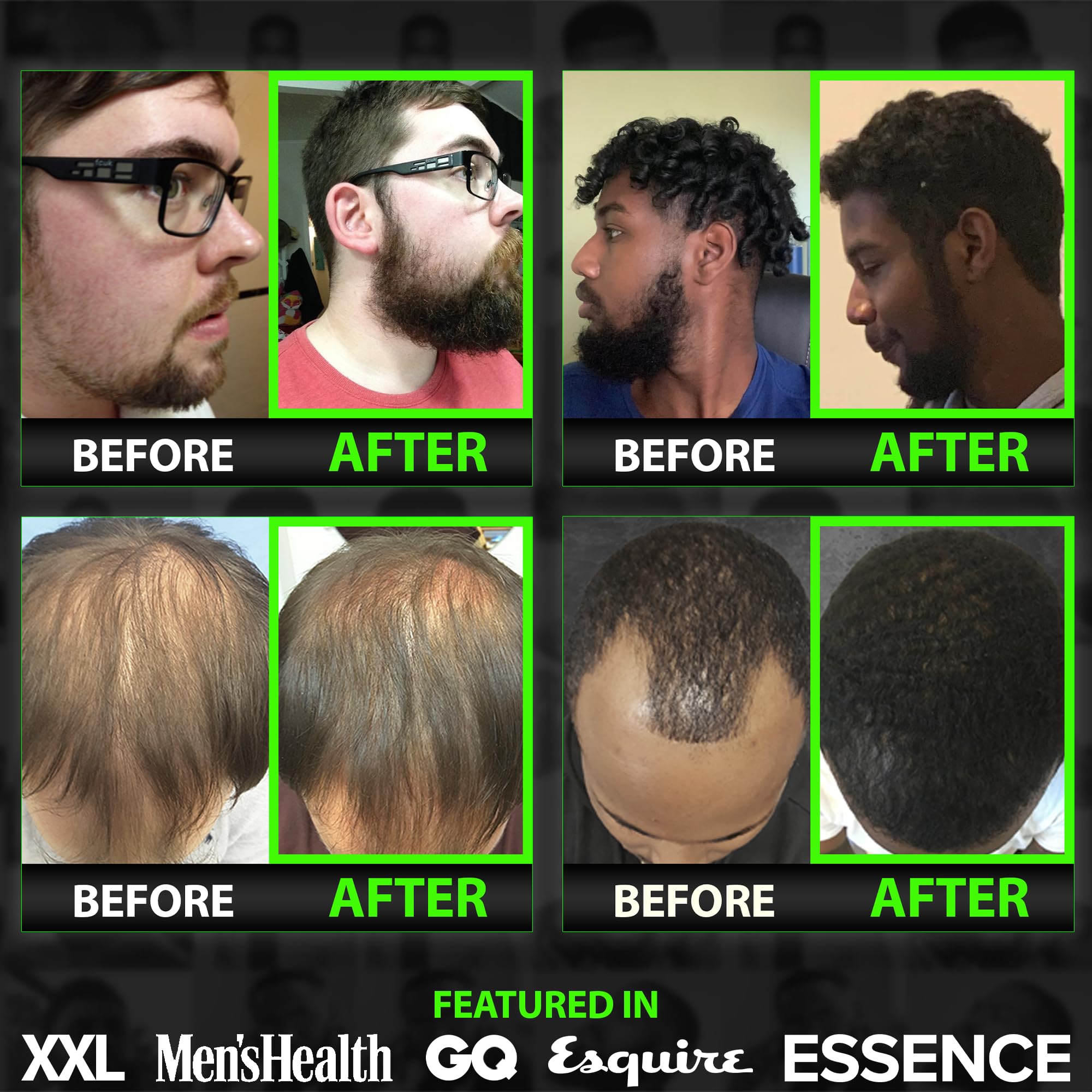 BBS Best Beard Stuff Grow Maximum hair closeup shows healthy shine and texture.