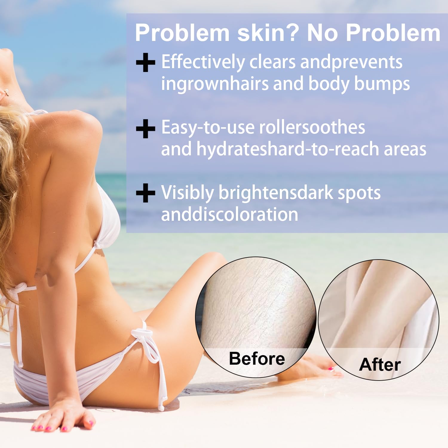 Bettenko Smoothing Solution on the bikini line supports comfortable wear and smooth skin.