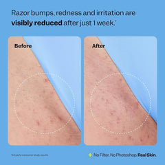 Bettenko Smoothing Solution provides hydration for smoother legs after shaving.