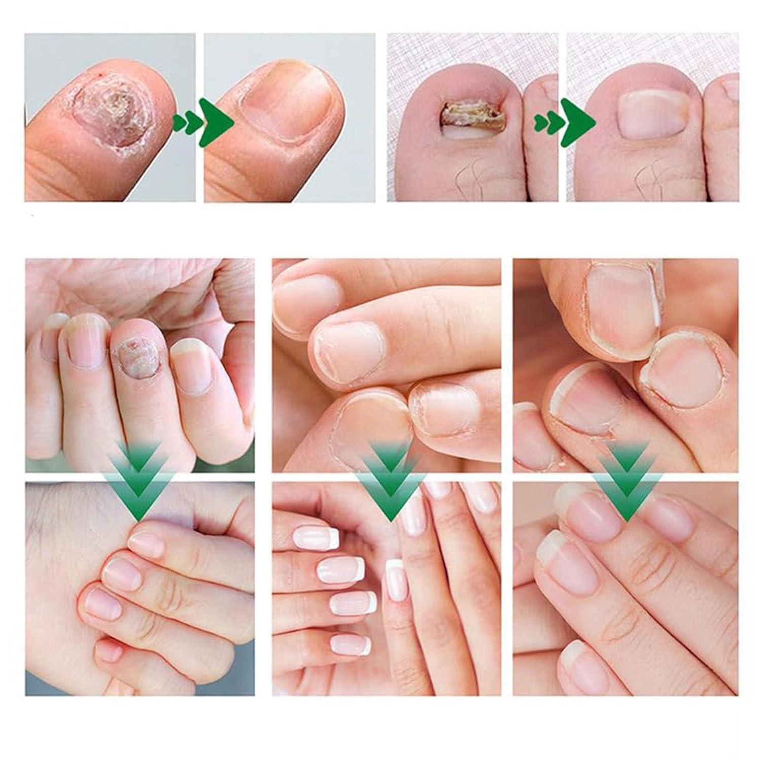 Beuifvo deep moisturizing gel texture close-up on nails.