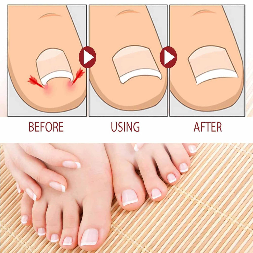 Beuifvo nail growth serum bottle close-up highlighting strength.