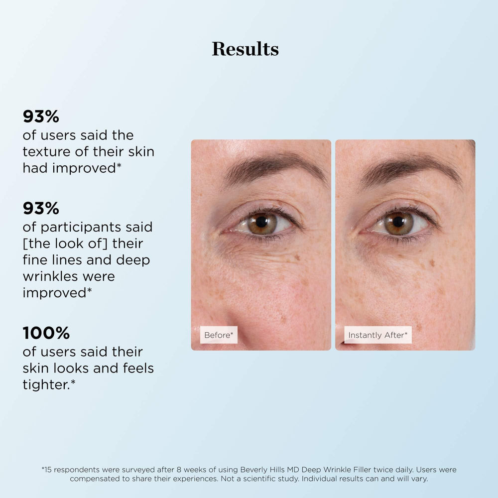 Beverly Hills MD Deep Wrinkle Filler with diamond dust detail for radiance