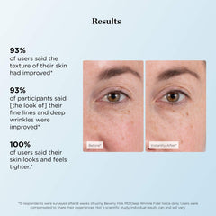 Beverly Hills MD Deep Wrinkle Filler with diamond dust detail for radiance