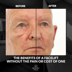Beverly Hills Mens Under-eye Puffiness visual signals drainage support for refreshed eyes.