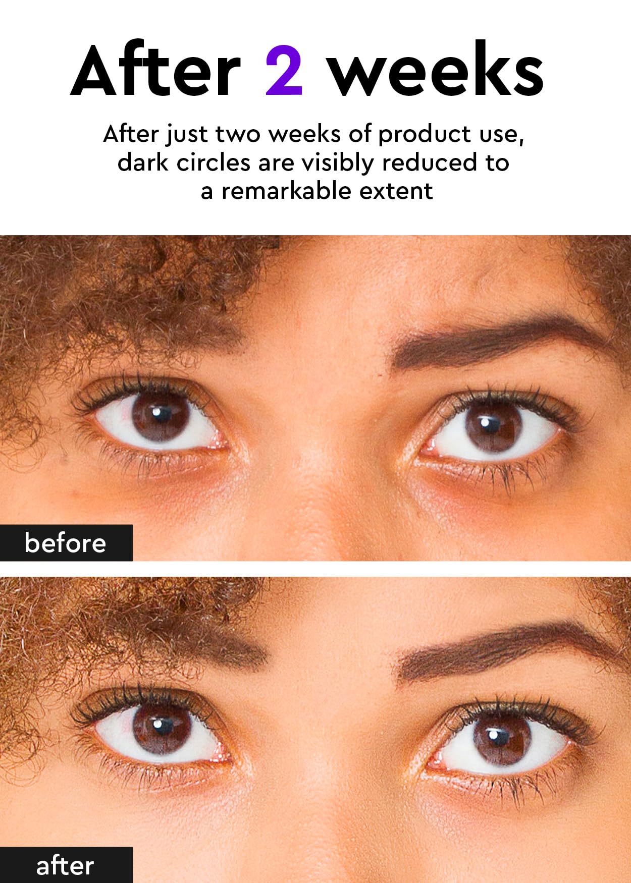 BE+WANTS Bewants under eye cream vegan collagen closeup highlights hydration and elasticity.