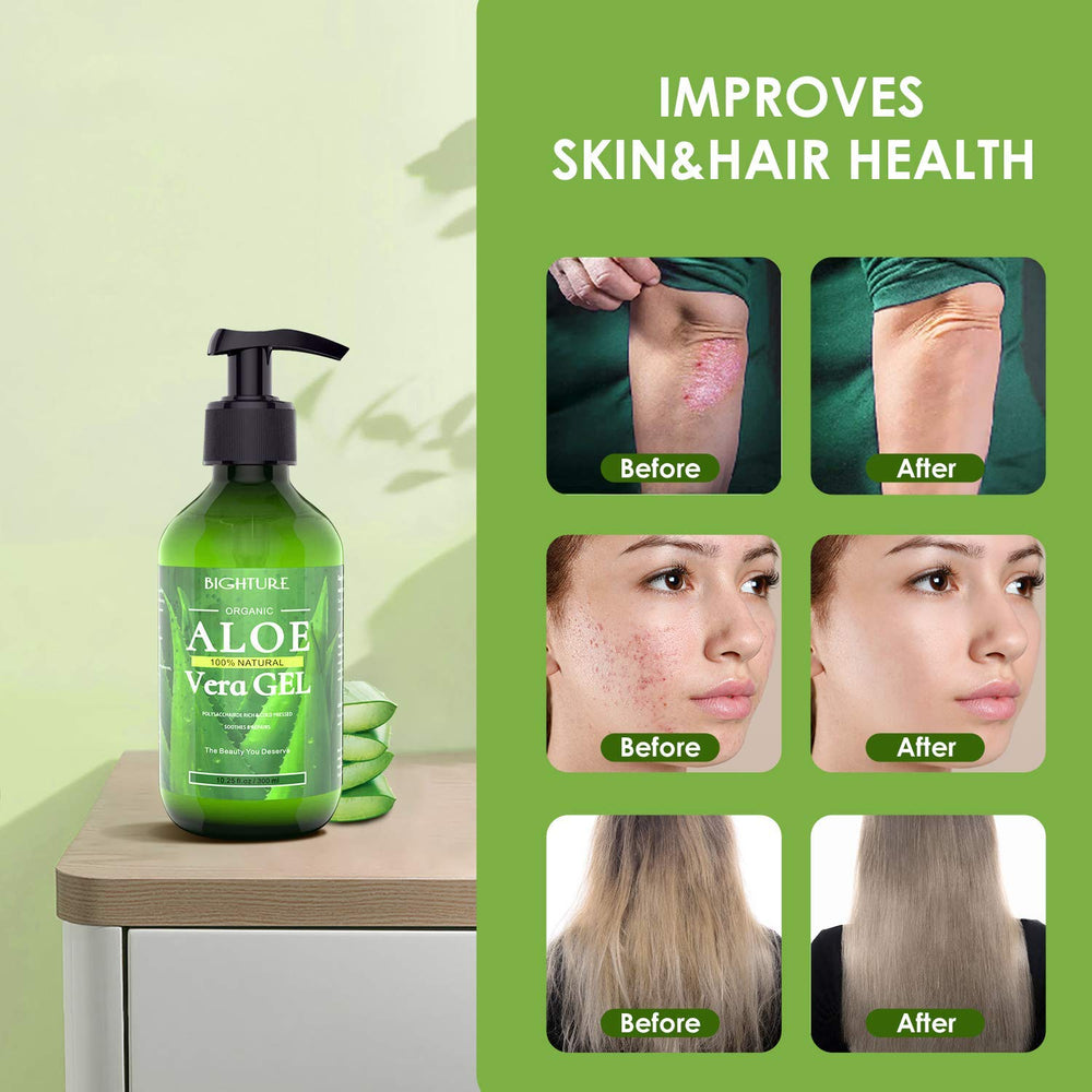 BIGHTURE Aloe Vera Gel after shaving for calm skin.