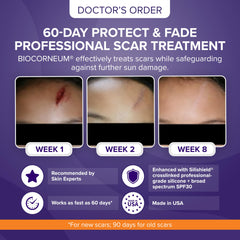 BIOCORNEUM SPF 30 swatch protects scars from sun exposure.