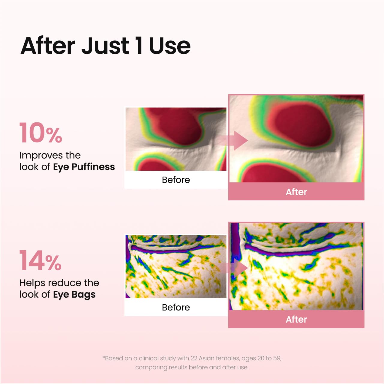 BIODANCE patch placed beside smile line illustrating targeted wrinkle smoothing
