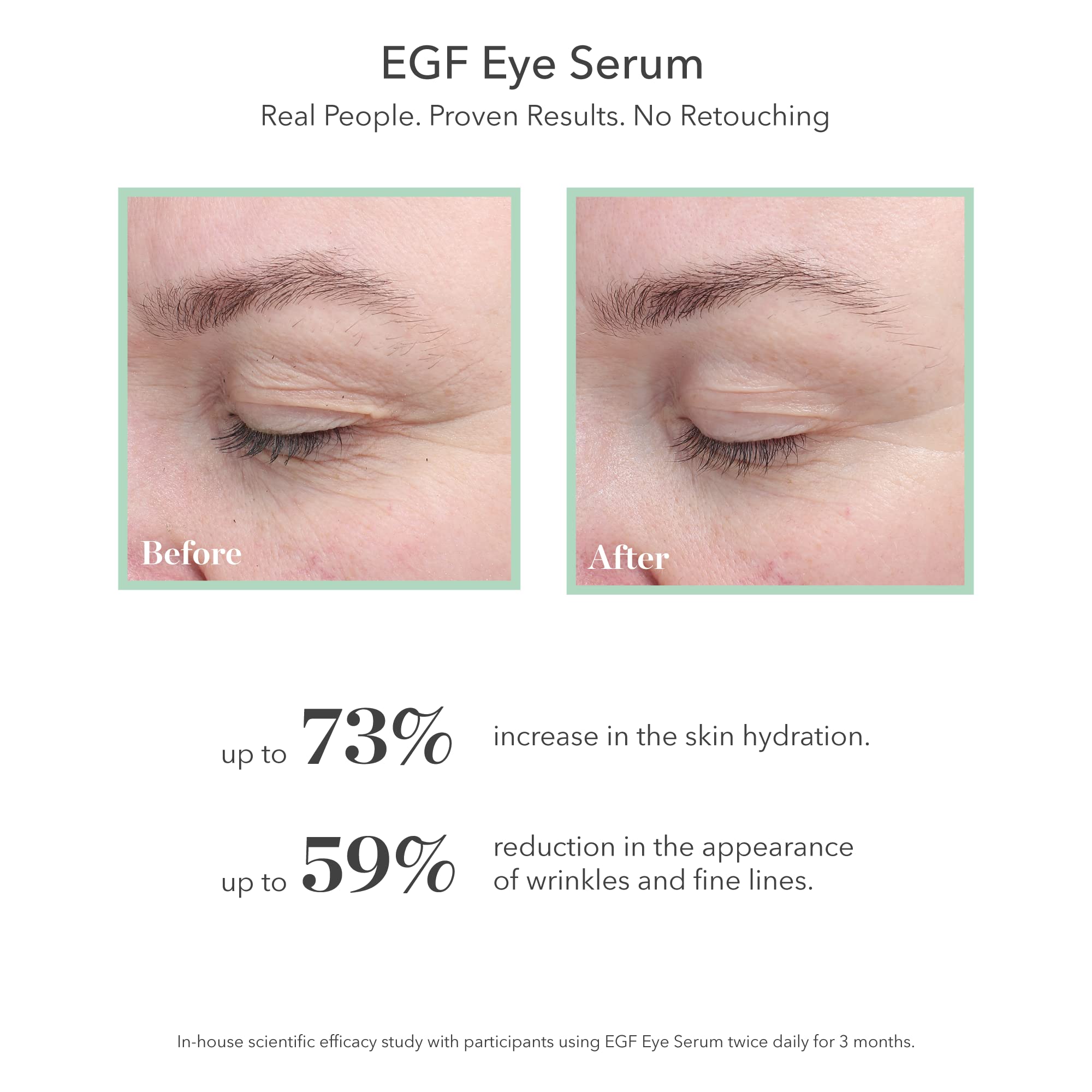BIOEFFECT EGF Eye Serum hydration boost improves skin density around the eye contour.