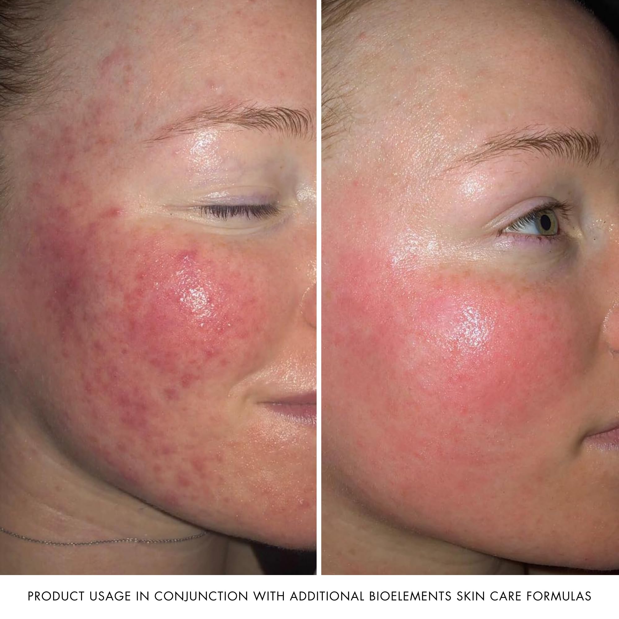 Bioelements Barrier Fix application AM PM showcases simple daily ritual