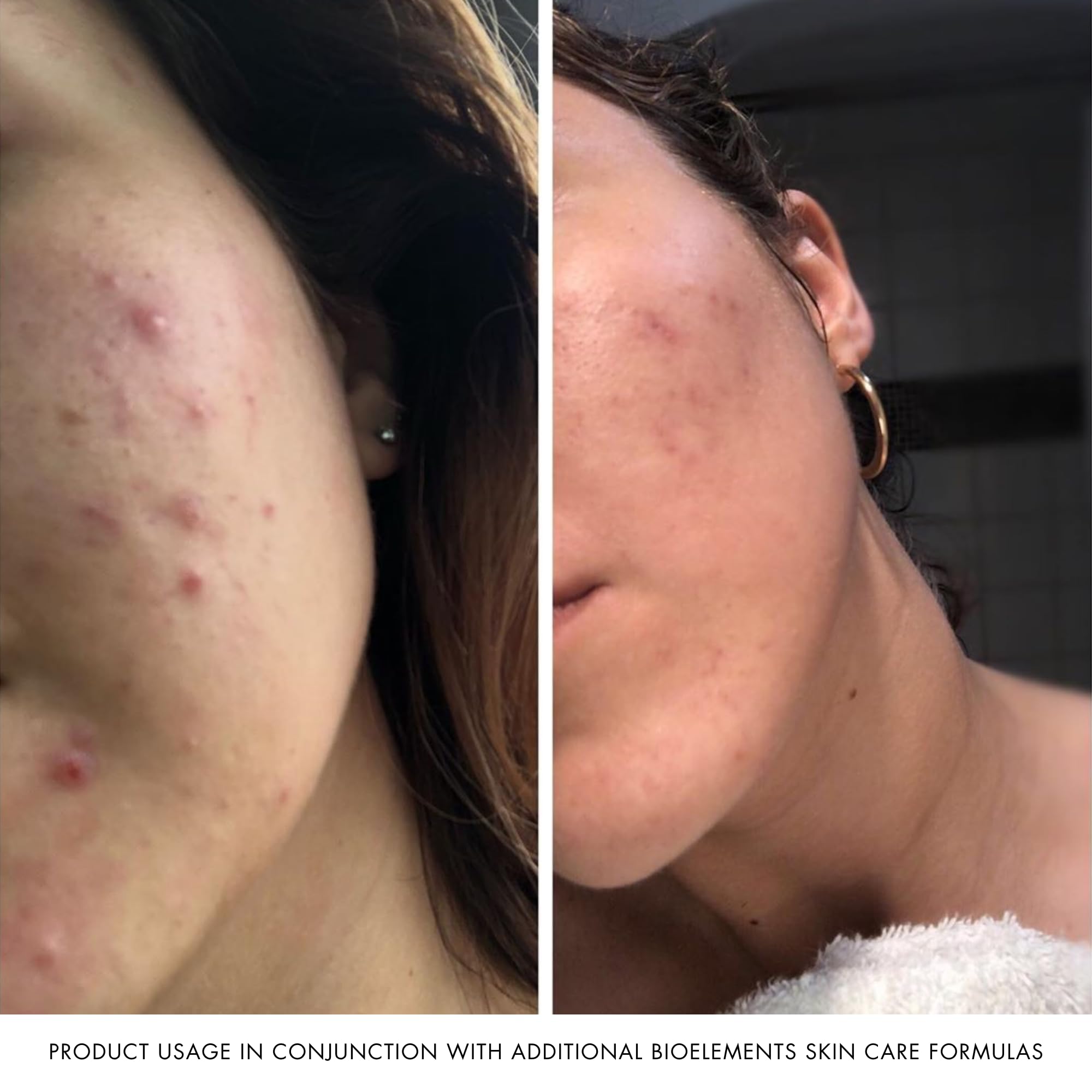 Bioelements Crucial Moisture adaptogenic herbs support skin resilience.