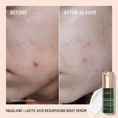 Biossance Rapid Radiance Set cream tube—nourishing hydration.