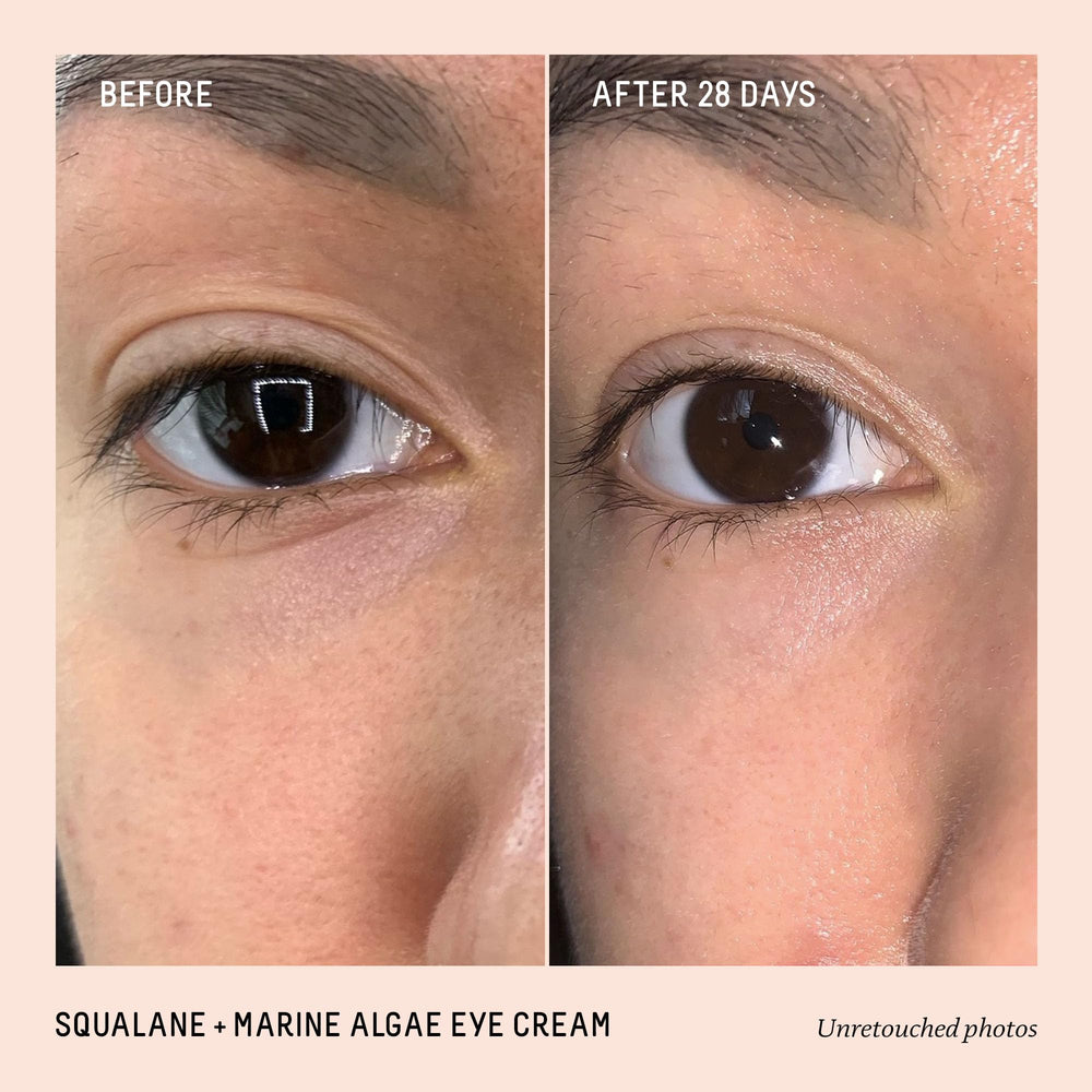 BIOSSANCE eye cream being applied under the eye for smooth, hydrated skin