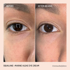BIOSSANCE eye cream being applied under the eye for smooth, hydrated skin