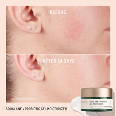 BIOSSANCE packaging close-up emphasizing probiotic balance and clean beauty branding.