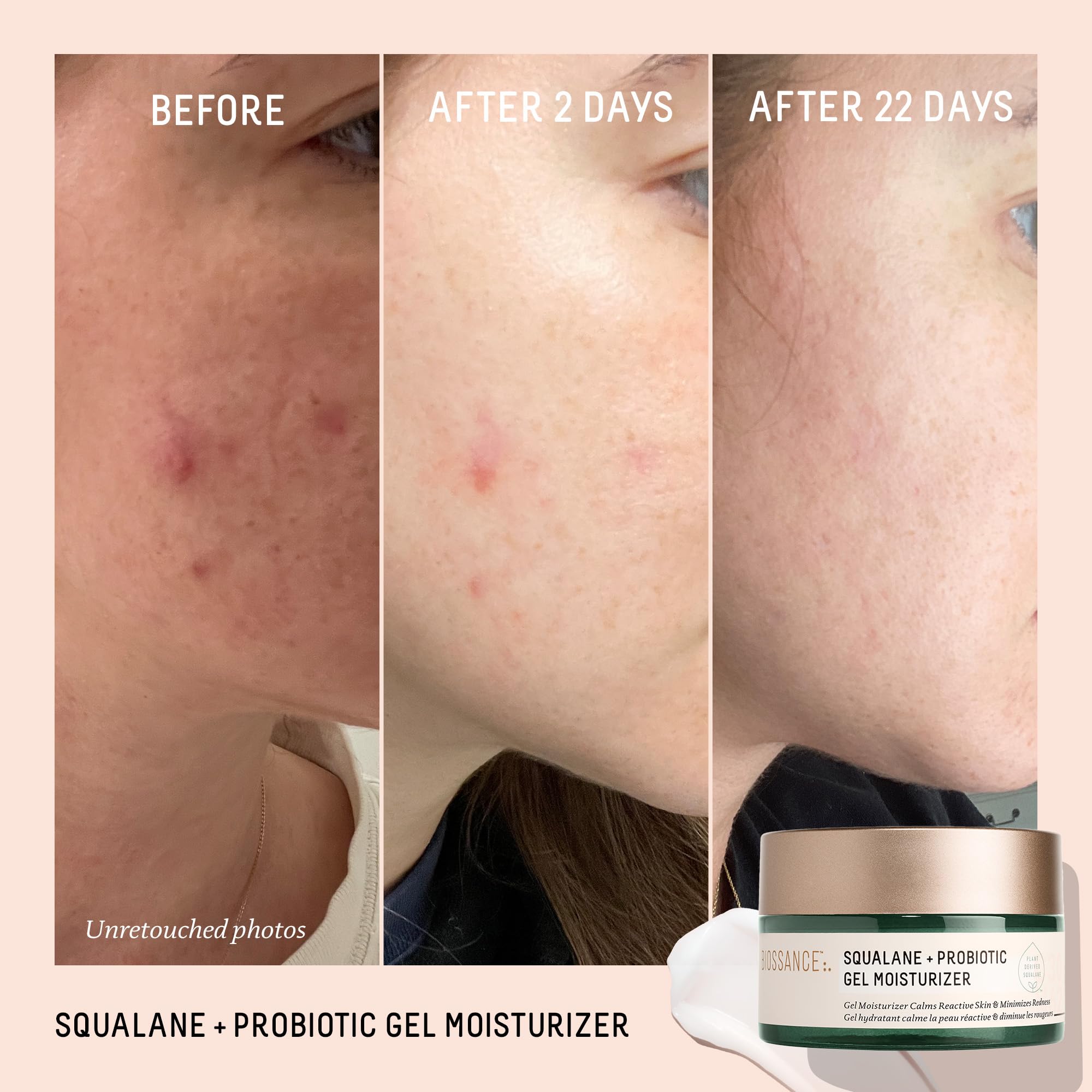 BIOSSANCE gel texture closeup illustrating refreshing, non-greasy feel for sensitive skin.