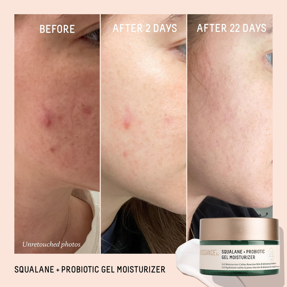 BIOSSANCE gel texture closeup illustrating refreshing, non-greasy feel for sensitive skin.