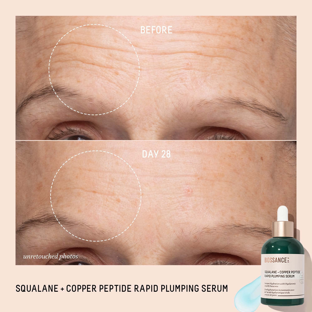 BIOSSANCE Sugarcane-sourced squalane oil drop provides nourishing hydration.