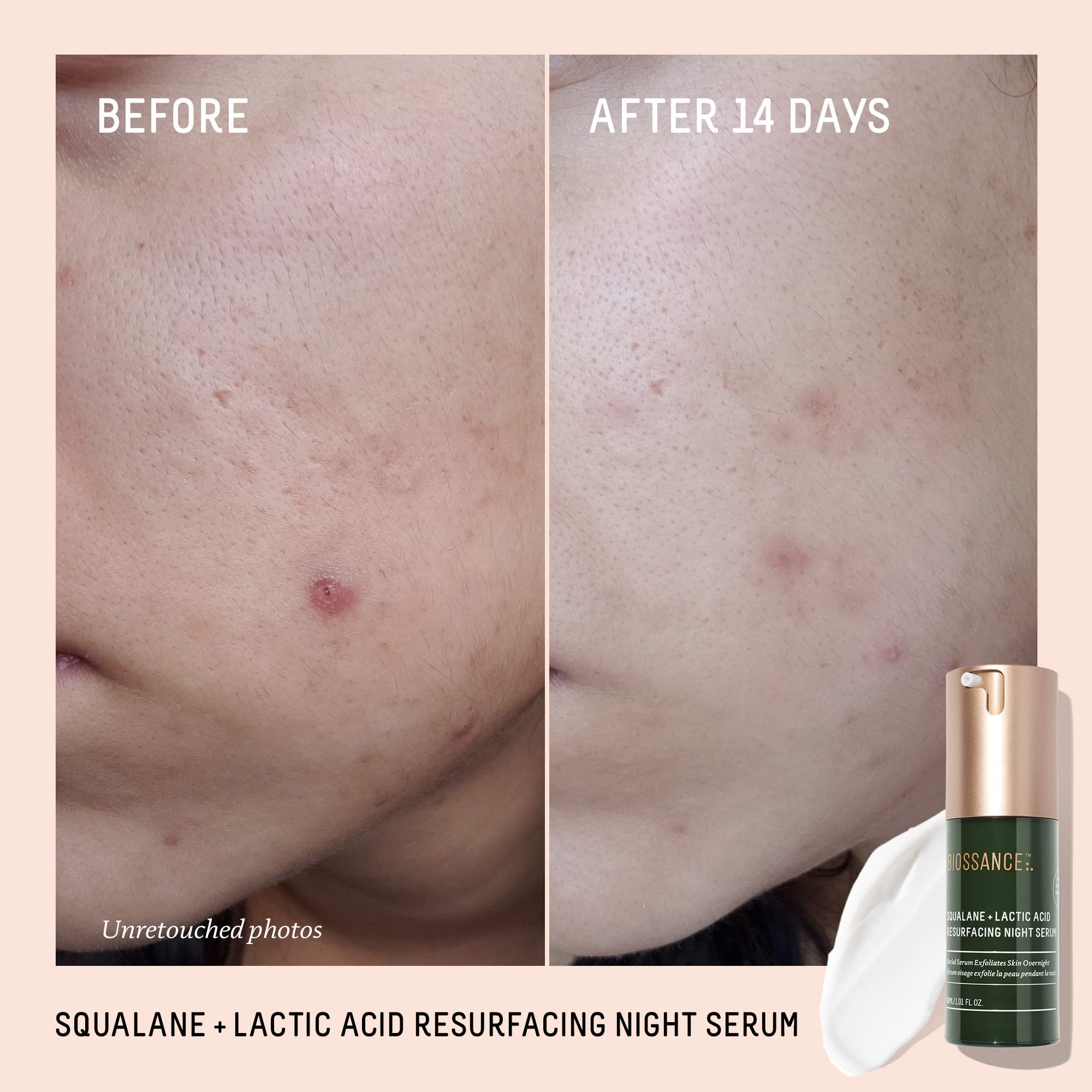 BIOSSANCE texture closeup reveals subtle skin refinement and gentle exfoliation cues