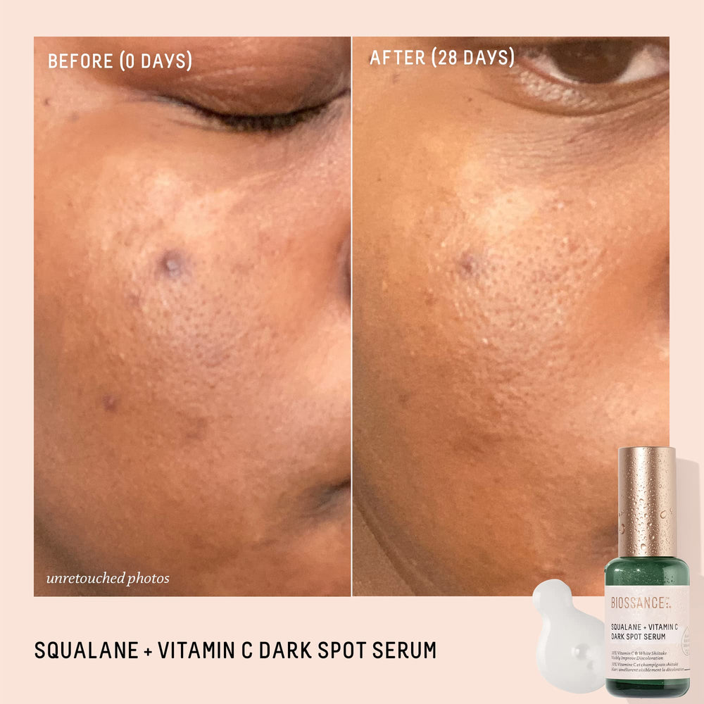 BIOSSANCE vitamin-c-10-percent-even-skin-tone close-up suggests brighter, more even-looking complexion