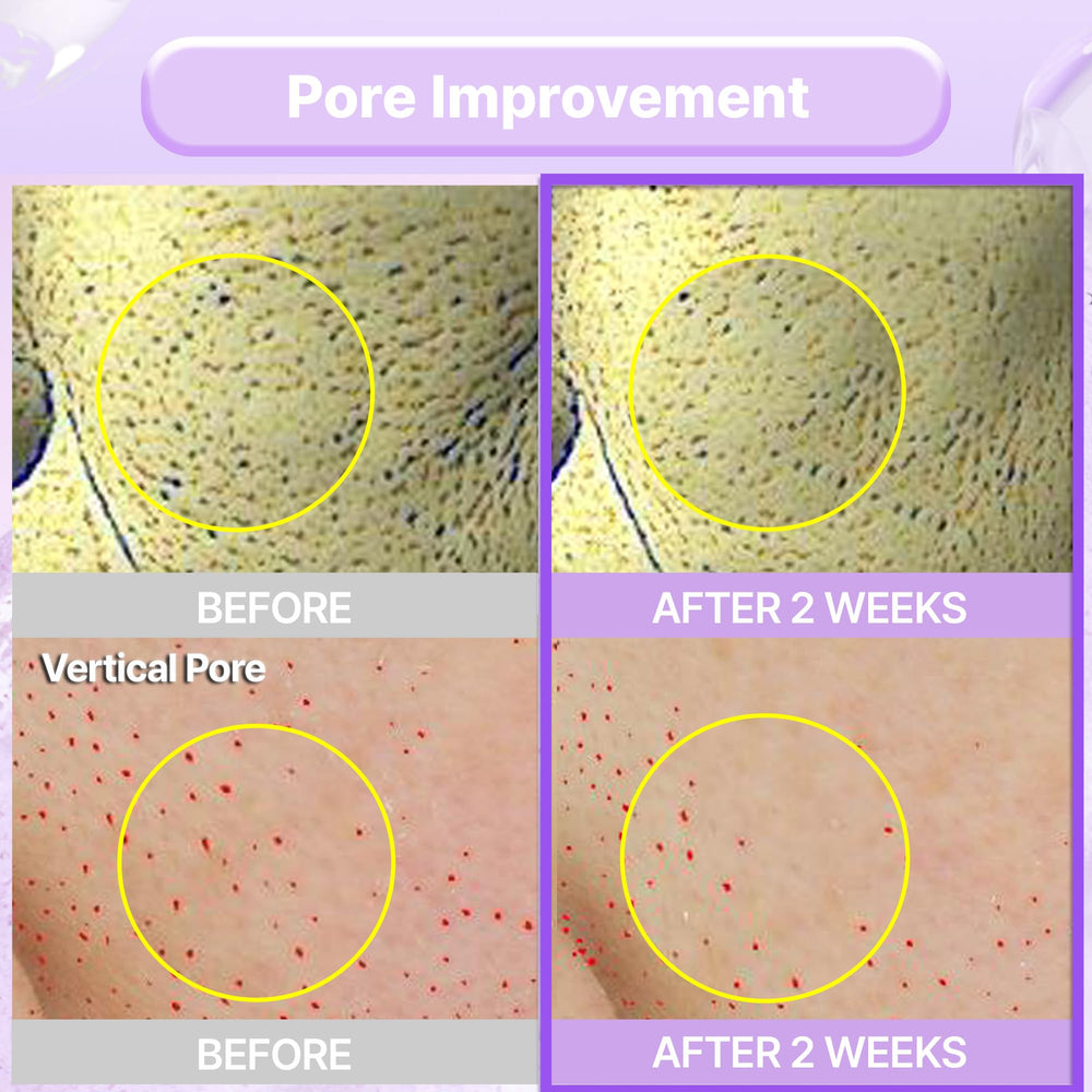 BIOHEAL BOH Probioderm lightweight moisturizer texture on skin with quick absorption
