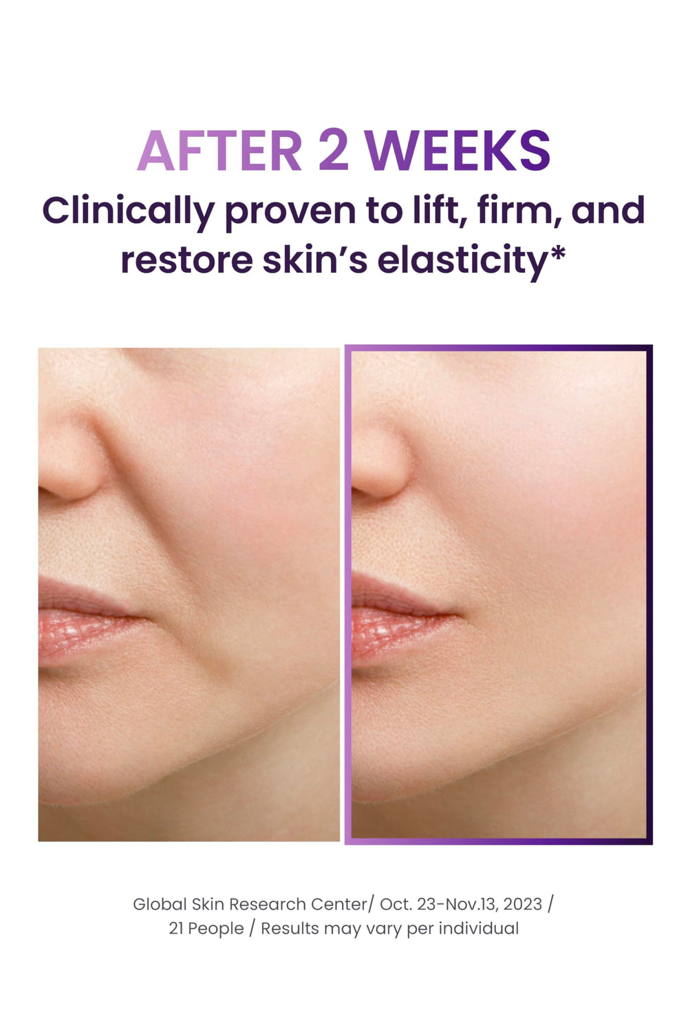 BIOHEAL BOH Probioderm serum ampoule closeup emphasizing smoothing and elasticity support.