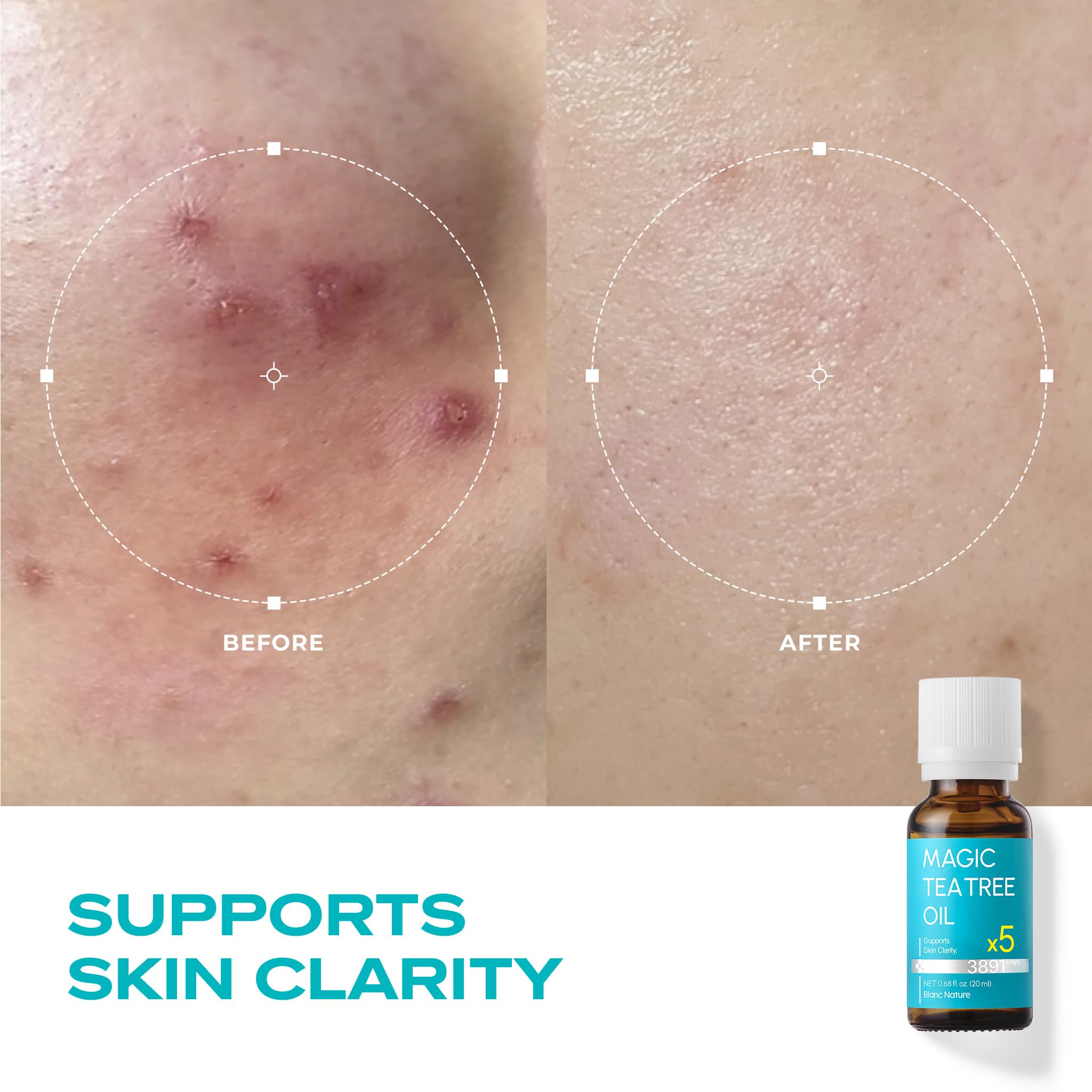BLANC NATURE Australian tea tree origin highlights soothing, refreshing benefits