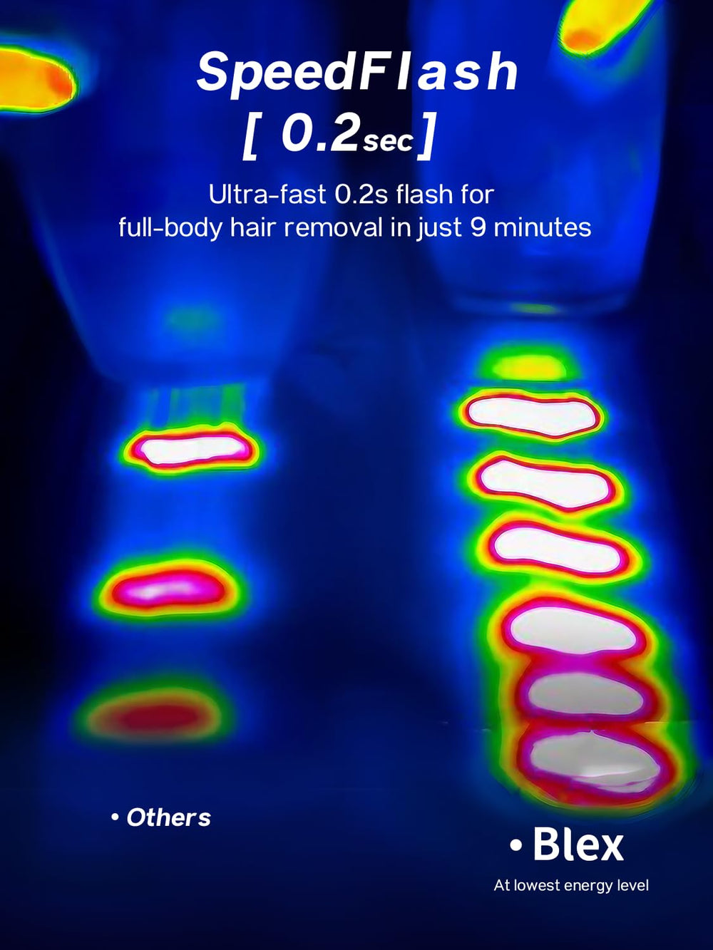 Blex dual-pulse technology close-up for efficient hair removal